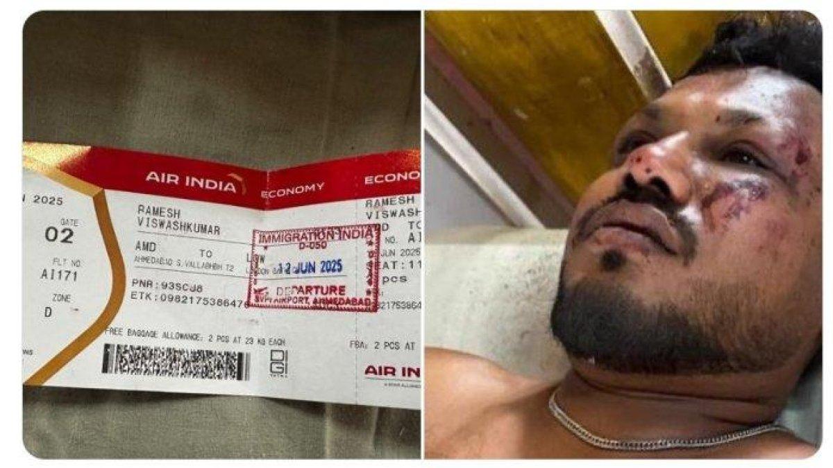 SATU PENUMPANG SELAMAT- Kecelakaan pesawat Air India di Ahmedabad secara ajaib menyisakan satu orang yang selamat. Korban selamat, yang sedang menjalani perawatan, telah diidentifikasi dia bernama Vishwas Kumar Ramesh, warga negara Inggris yang kembali ke London setelah kunjungan ke Gujarat.