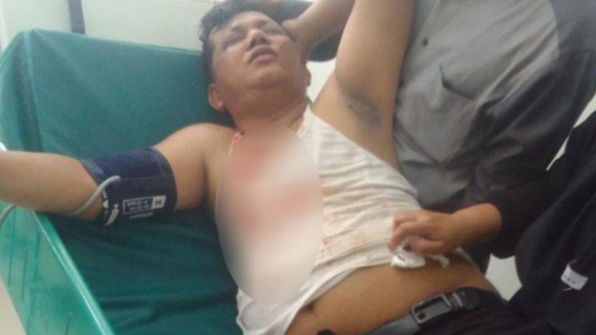 Kepala desa di Bekasi tertimpa baliho Caleg saat mengendarai motor
