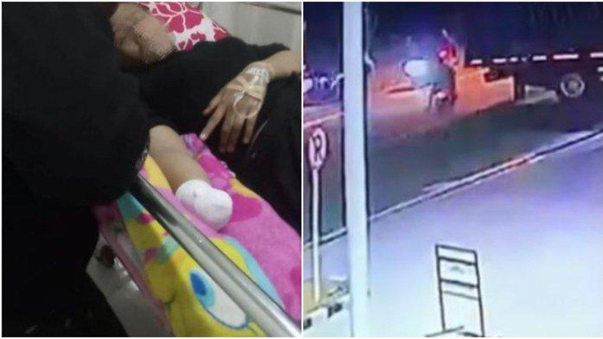 (Kiri) RA, remaja putri yang tangannya putus usai dipacok gangster