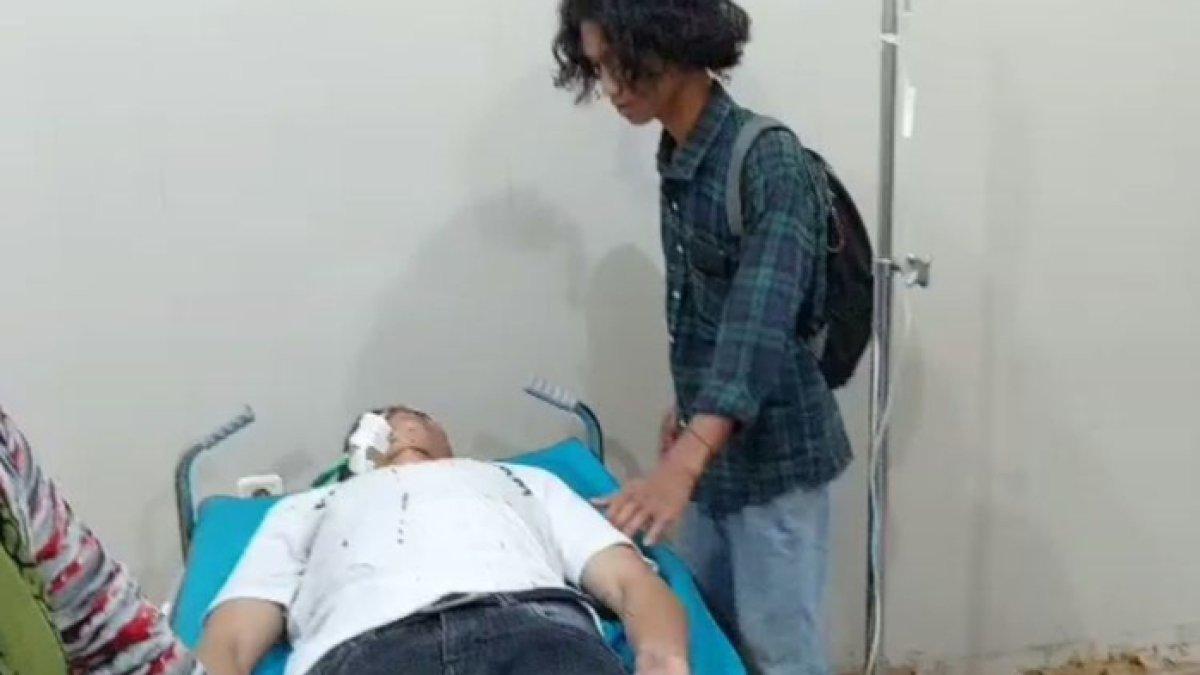 Kondisi korban setelah wajahnya dipanah oleh OTK di Gowa, Sulawesi Selatan