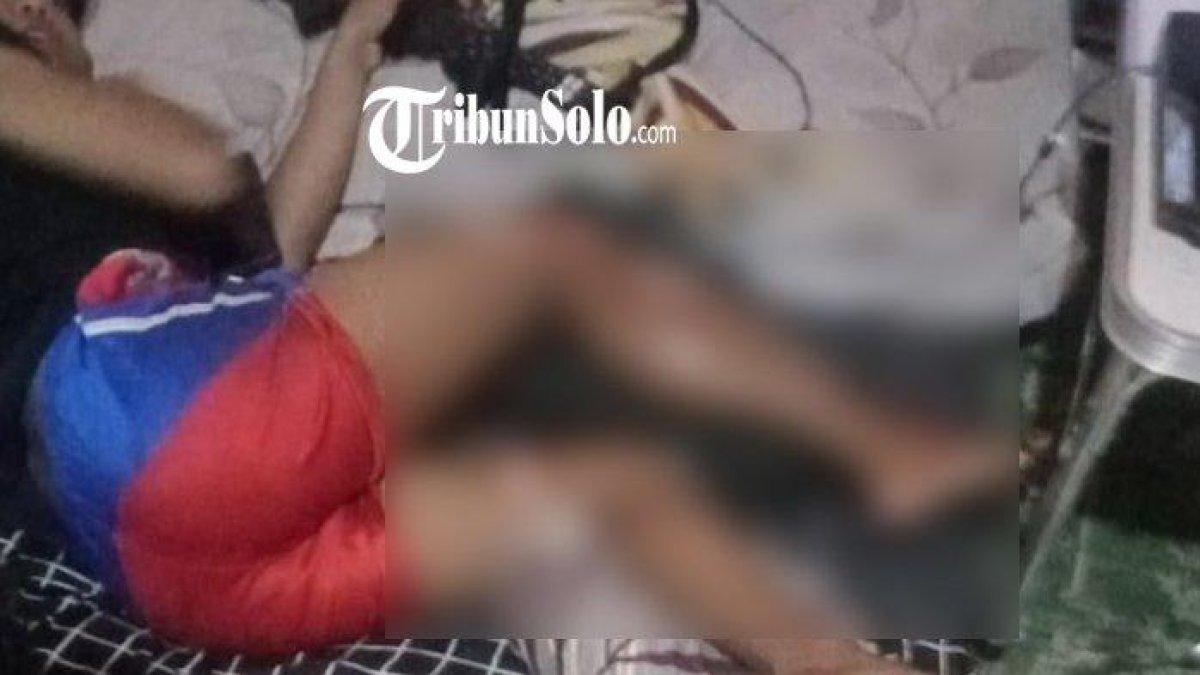 Kondisi luka korban begal Sabtu (2/3/2024) di Jalan Slamet Riyadi.