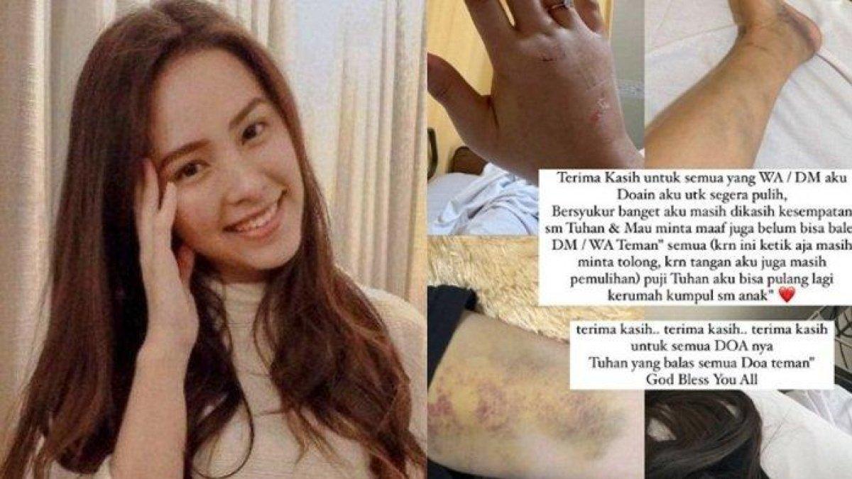 Kondisi terkini Lady Nayoan