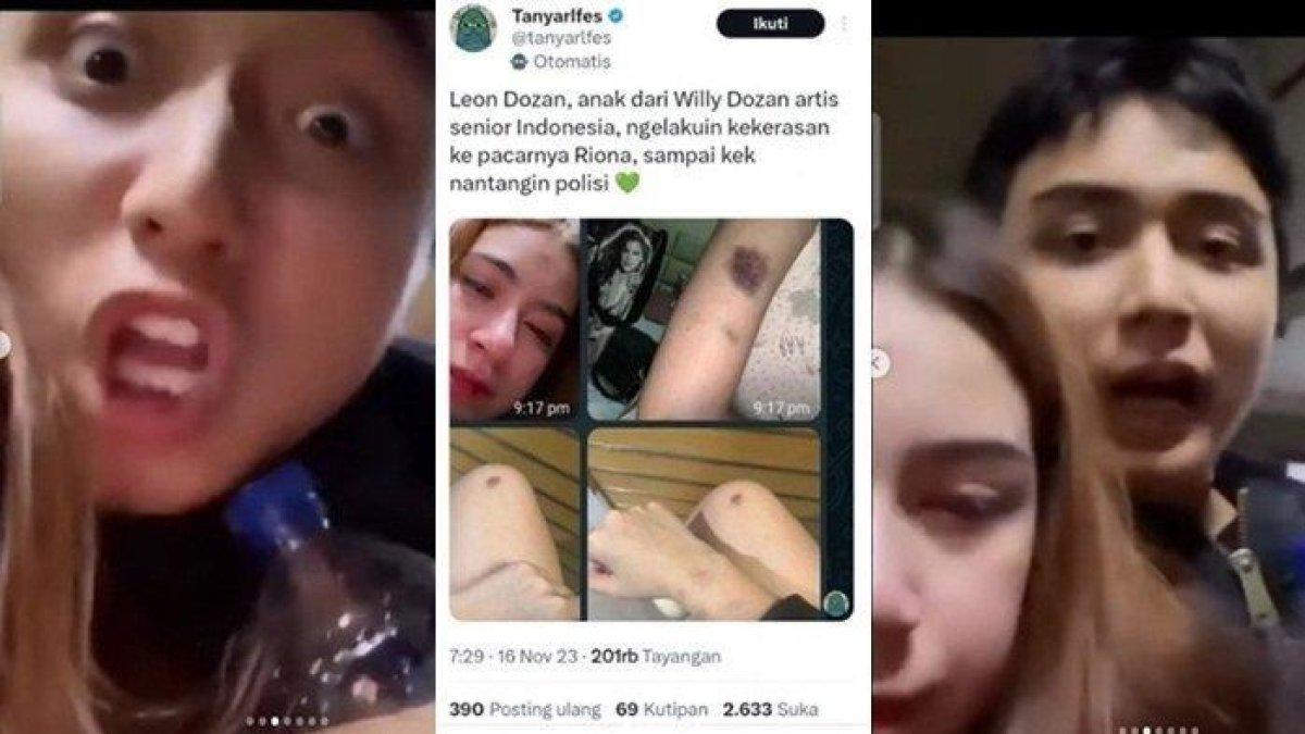 Leon Dozan, pelaku penganiayaan terhadap pacarnya, Rinoa Aurora