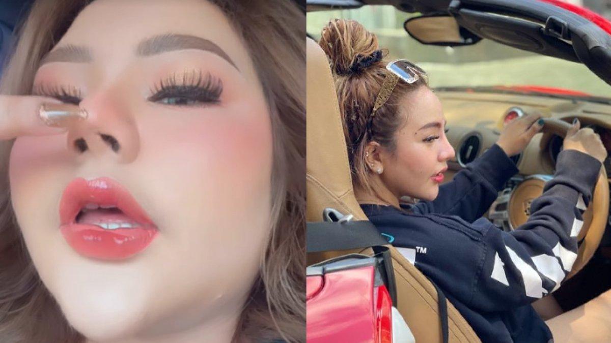 KEANEHAN HIDUNG LISA - Potret Lisa Mariana diambil dari Instagram pada Jumat (2/5/2025). Lisa Mariana mengaku sempat alami kecelakaan setelah operasi plastik bagian hidung.