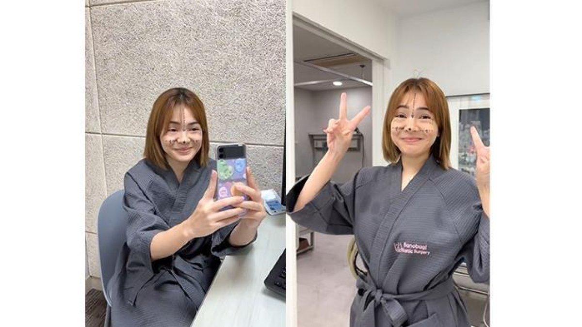 Maya Septha operasi plastik di Korea Selatan.