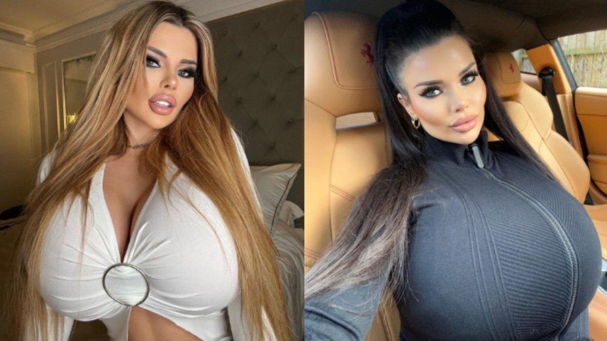 Gaya Model dengan Payudara Super Besar Senilai Rp800 juta, Ketagihan Pasang  Implan hingga 14 Kali - Tribunnewsmaker.com