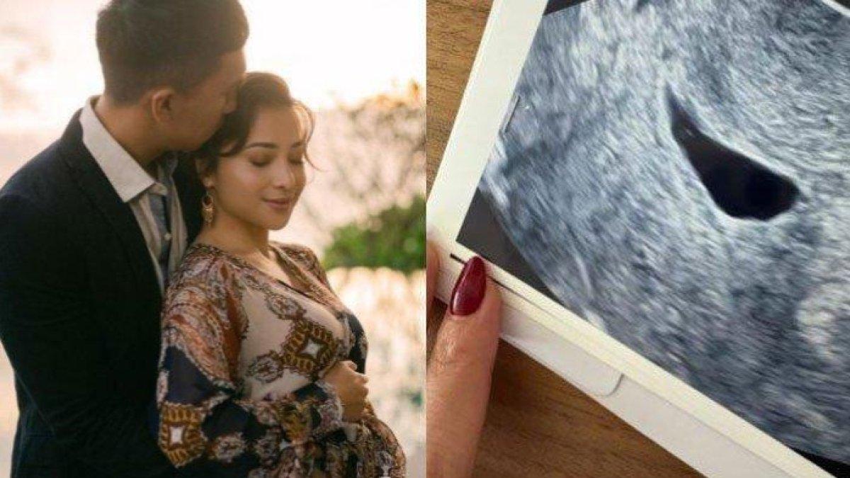 Nikita Willy cerita pengalamannya saat keguguran calon anak kedua