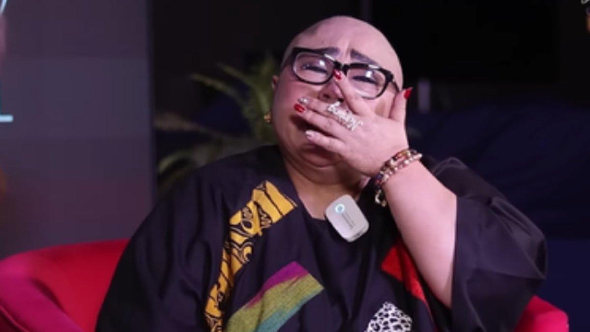 Nunung berkepala botak karena kanker