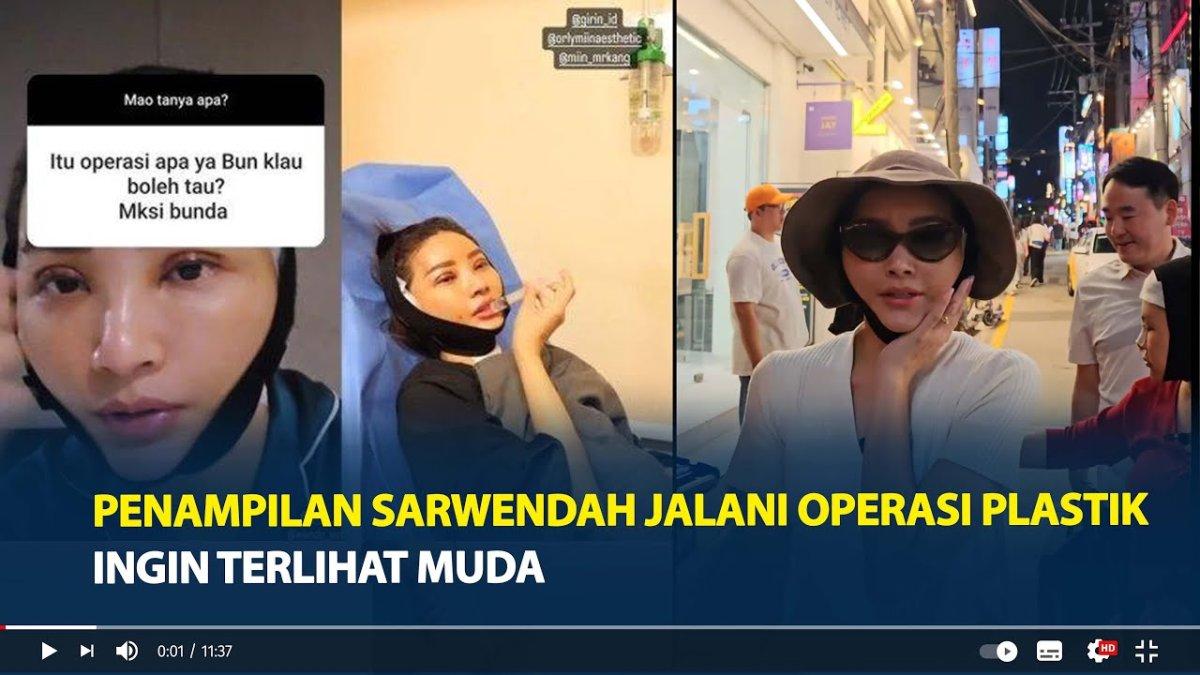 Sarwendah jalani oplas wajah di tengah perceraian dengan Ruben Onsu