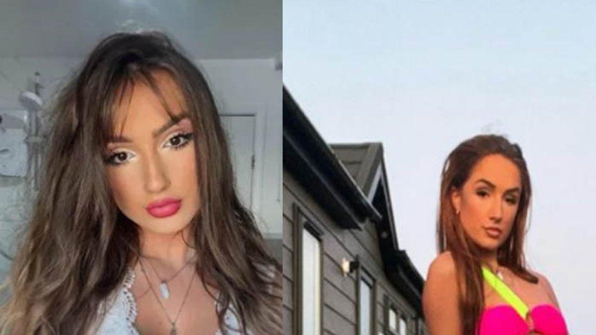 Penampilan wanita berubah, dulunya dibully, kini jadi model.