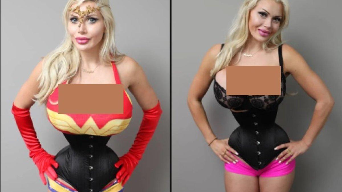 Pixiee Fox harus menghilangkan enam tulang rusuknya agar dia terlihat seperti karakter kartun.