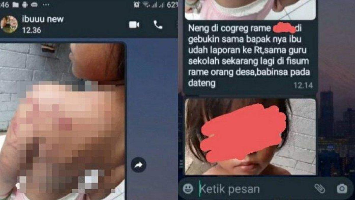 Potret bocah dianiaya orangtua, dipaksa ngamen