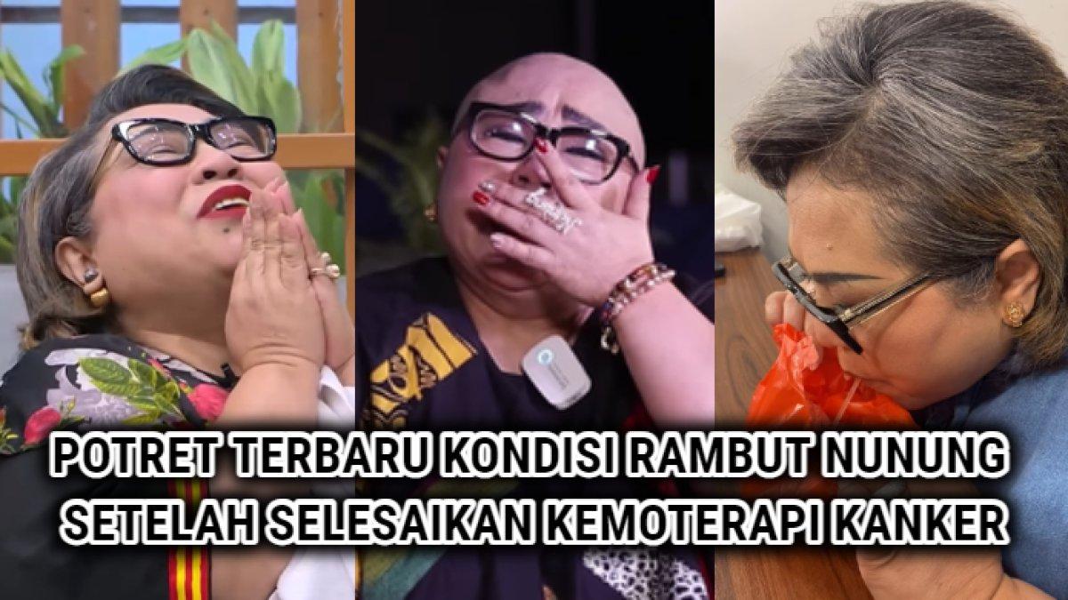 Potret terbaru rambut Nunung setelah selesaikan beberapa kali kemoterapi kanker