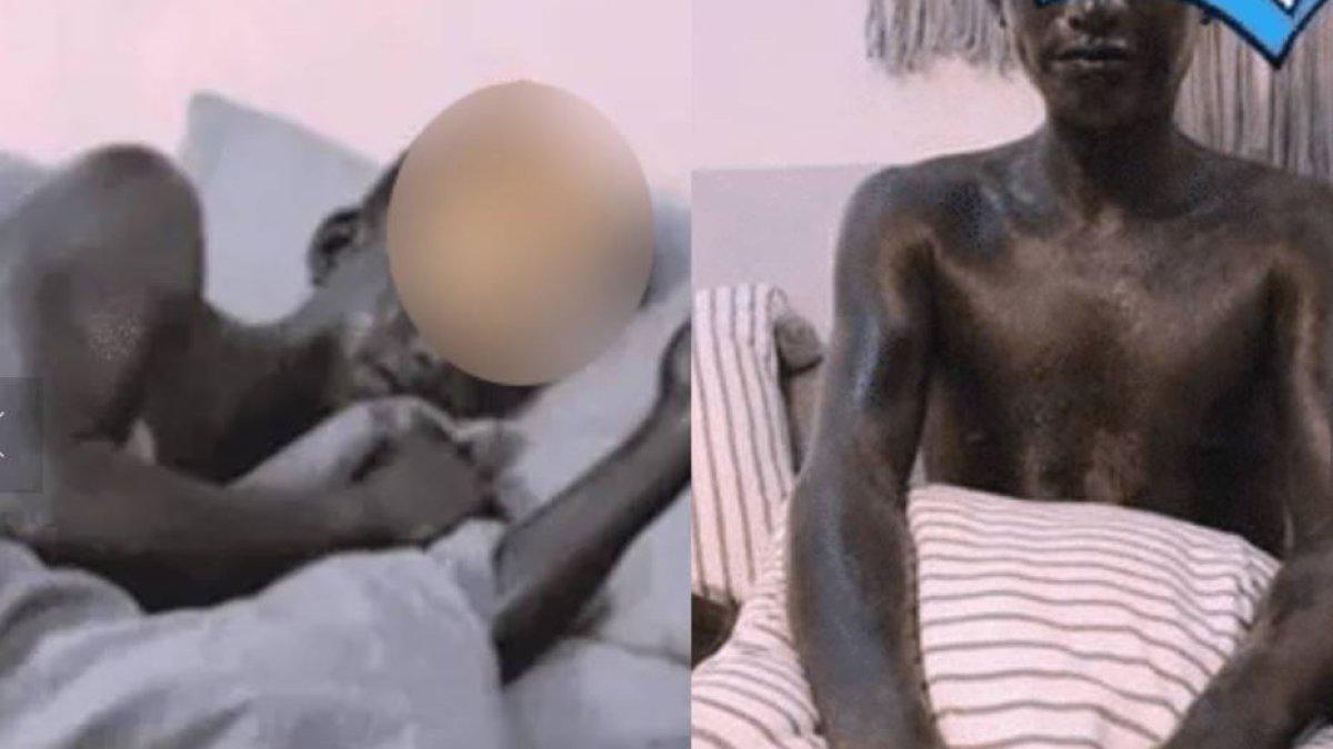 Pria syok bangun tidur tubuhnya jadi hitam.