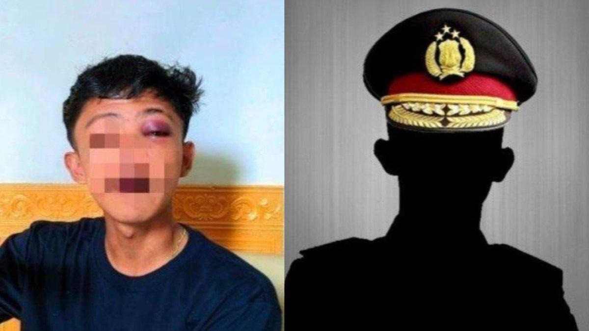 Remaja di Gorontalo mendadak dianiaya oknum polisi lalu diberi uang tutup mulut Rp50 ribu.