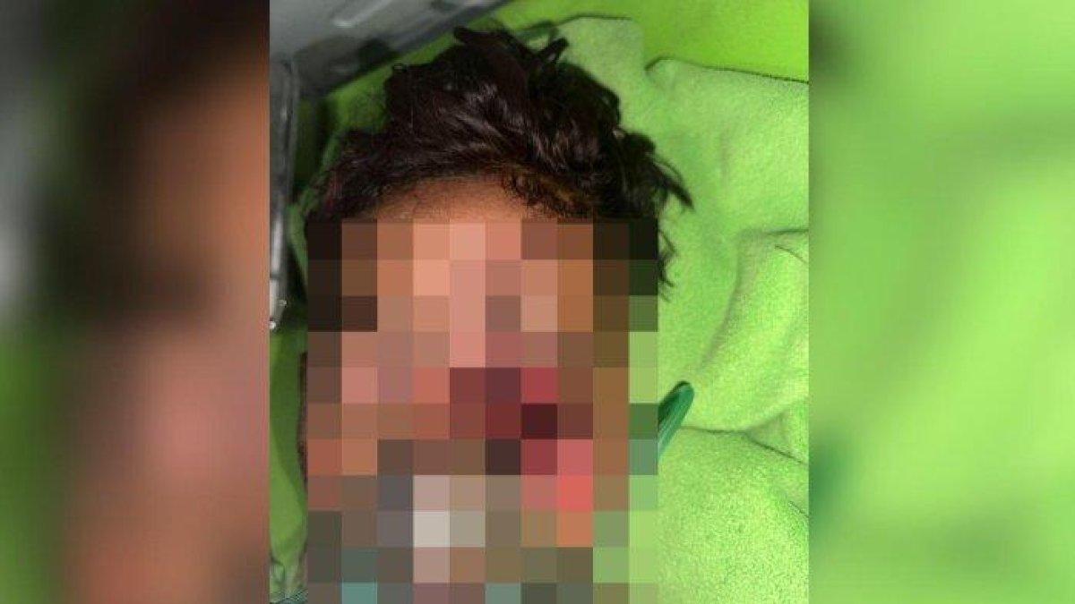 Kondisi almarhum IMP (16) remaja di Labuhanbatu tewas diduga akibat bola mata sebelah kirinya hilang disiksa orang tak dikenal.