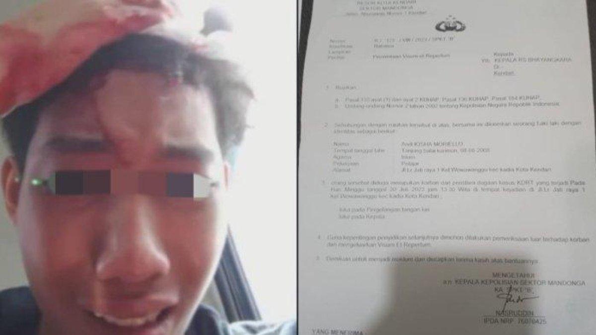 Remaja dibacok ayahnya sendiri yang merupakan hakim terpandang di Kendari, ditolong istri pertama, dilaporkan istri ketiga