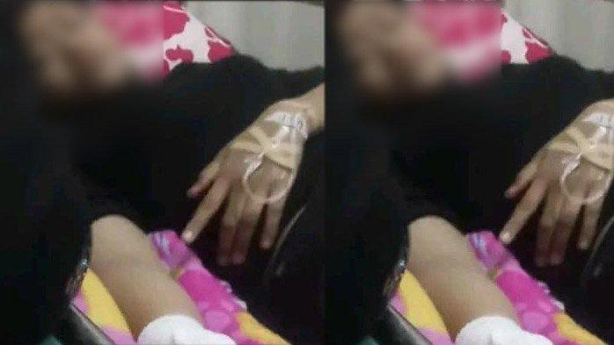 Remaja RA (14) asal Lamongan yang lengannya putus usai dibacok di Tuban, sedang dalam perawatan di RSUD dr Soetomo Surabaya.