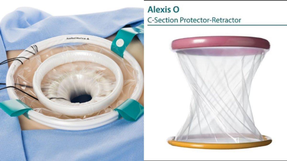 Retractor Pelindung Luka Alexis