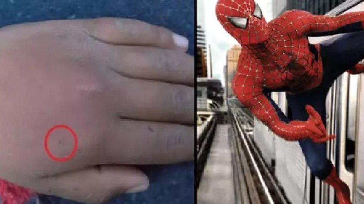 SOSOK bocah 8 tahun yang rela digigit laba-laba demi jadi Spider-Man