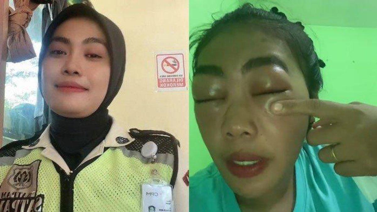 Satpam cantik syok bibir dan matanya mendadak bengkak