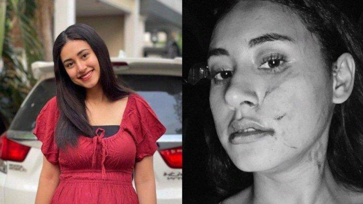 Selebgram Afifah Riyad mendapatkan penganiayaan dari mantan kekasih suaminya