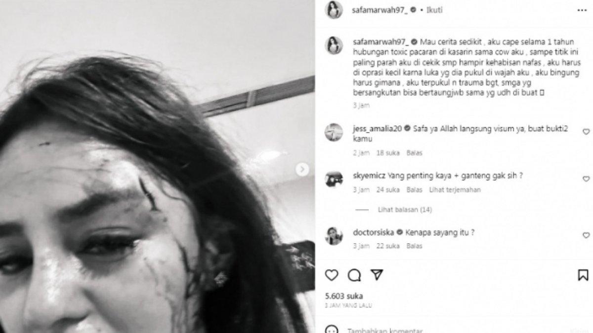Selebgram Safa Marwah dianiaya oknum PNS di Menteng, Jakarta Barat