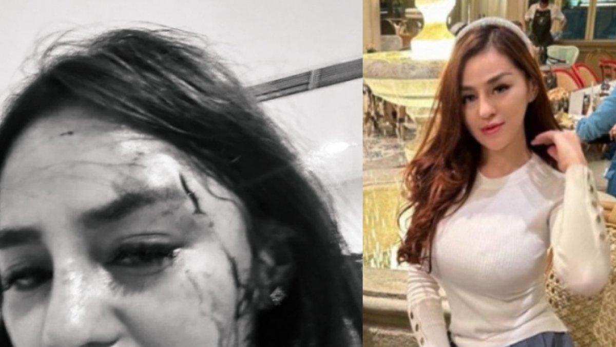 Selebgram Safa Marwah dianiaya oknum PNS di Menteng, Jakarta Barat