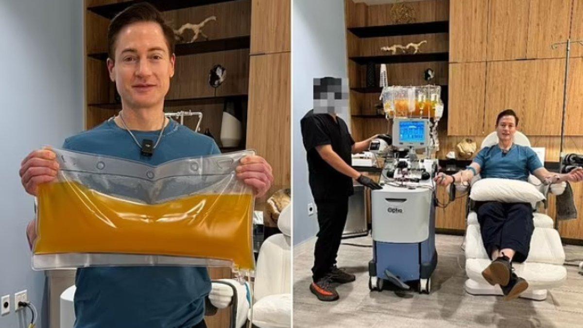 Sosok Bryan Johnson, miliarder asal Amerika Serikat yang mengganti plasma darahnya dengan albumin demi awet muda dan hidup abadi.
