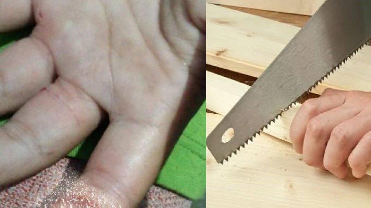 Tangan bocah digergaji ayah di Kuningan