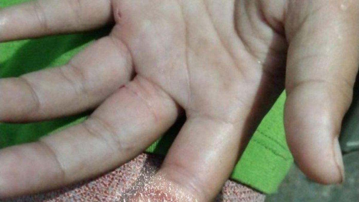 Tangan bocah digergaji ayah di Kuningan