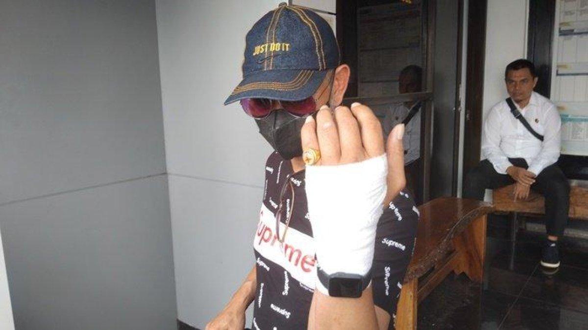 Tangan membusuk usai infus diare, Petrus (58) seorang pasien melaporkan dugaan kasus malapraktik yang terjadi salah satu rumah sakit di Palembang ke Polda Sumsel. Kuasa hukum mendampingi korban dugaan malpraktik ketika datang ke Polda Sumsel, Rabu (10/1/2024).