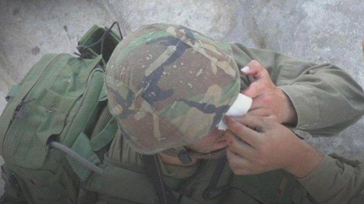 ALAMI KEBUTAAN- Media Israel menyampaikan informasi banyak tentara Israel mengalami kebutaan setelah perang melawan pejuang Hamas di Gaza. Sekitar 100 tentara Israel terluka di bagian mata, banyak yang kemudian menjadi buta saat mereka bertempur di Gaza.