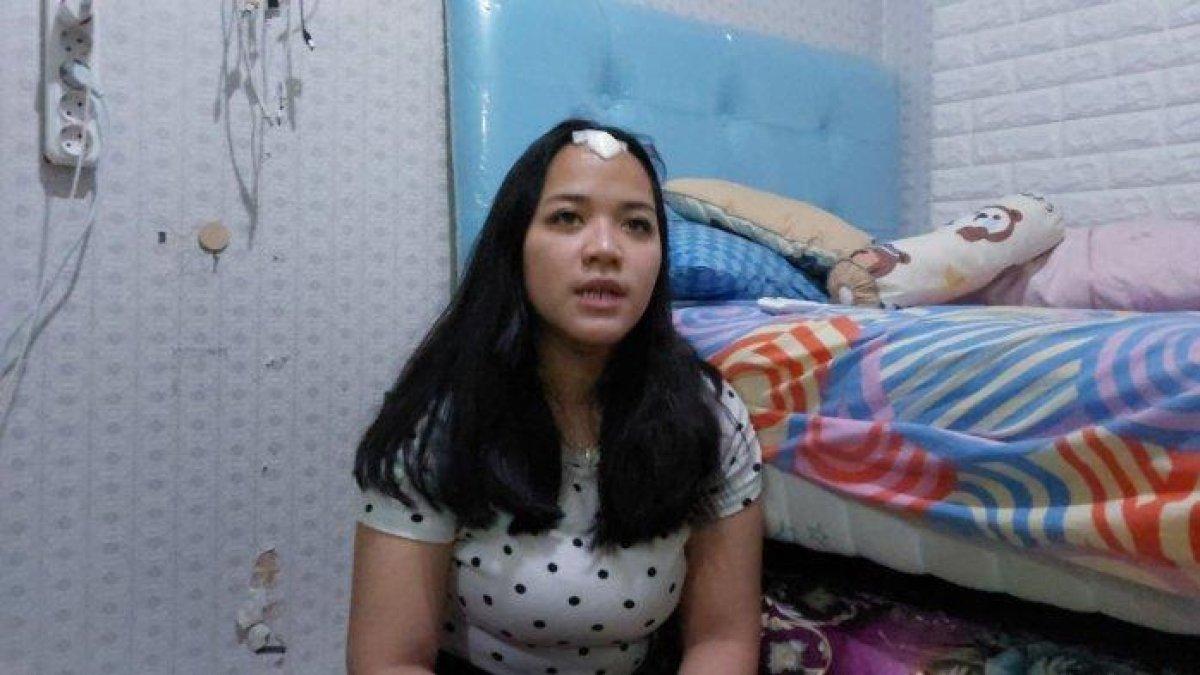 Titani Eifely, jadi korban kekerasan dalam rumah tangga (KDRT) yang diduga dilakukan suaminya, KL