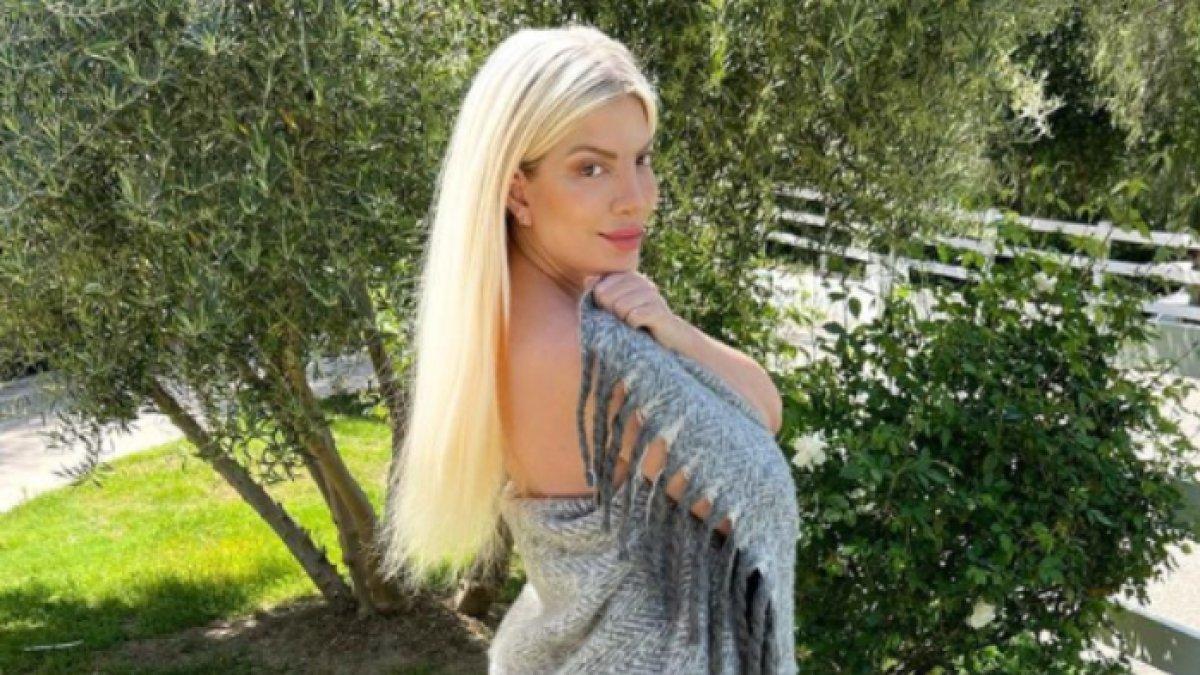 Tori Spelling disebut rajin lakukan filler