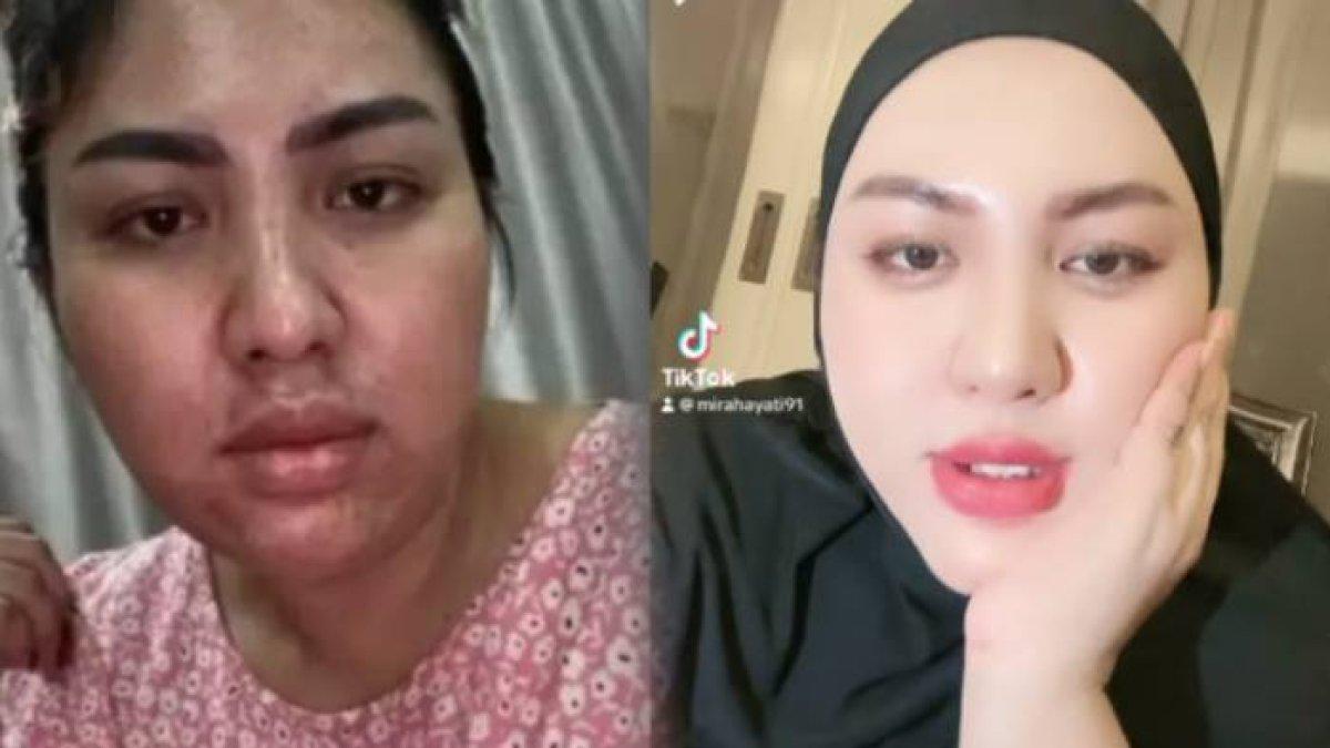 Transformasi Mira Hayati