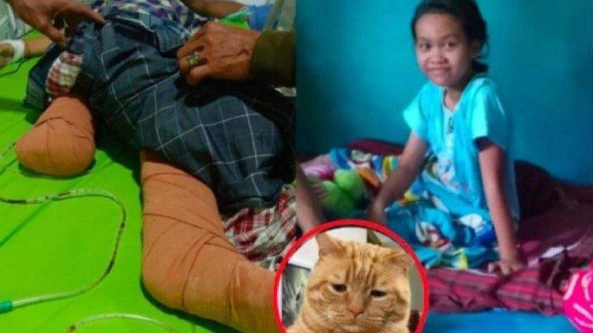 Viral Kisah Nabila Febrianti Bocah SD Kakinya Terlindas Truk Saat Selamatkan Kucing