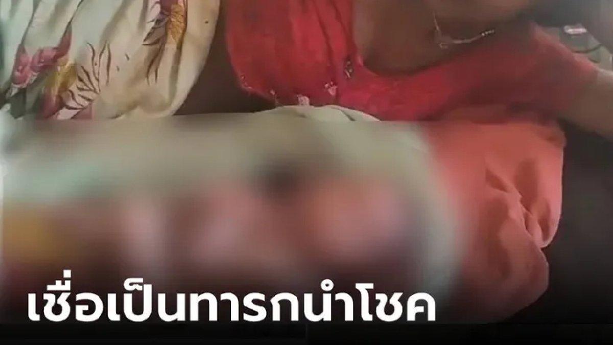Viral bayi lahir dengan 2 wajah dan 8 anggota badan