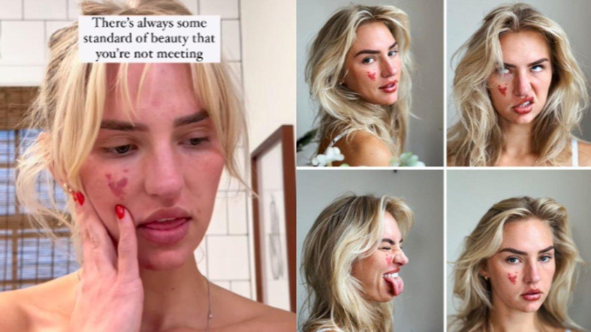 Wanita dengan tompel jumbo di wajah, kini jadi influencer, dulu dibully kini bangga