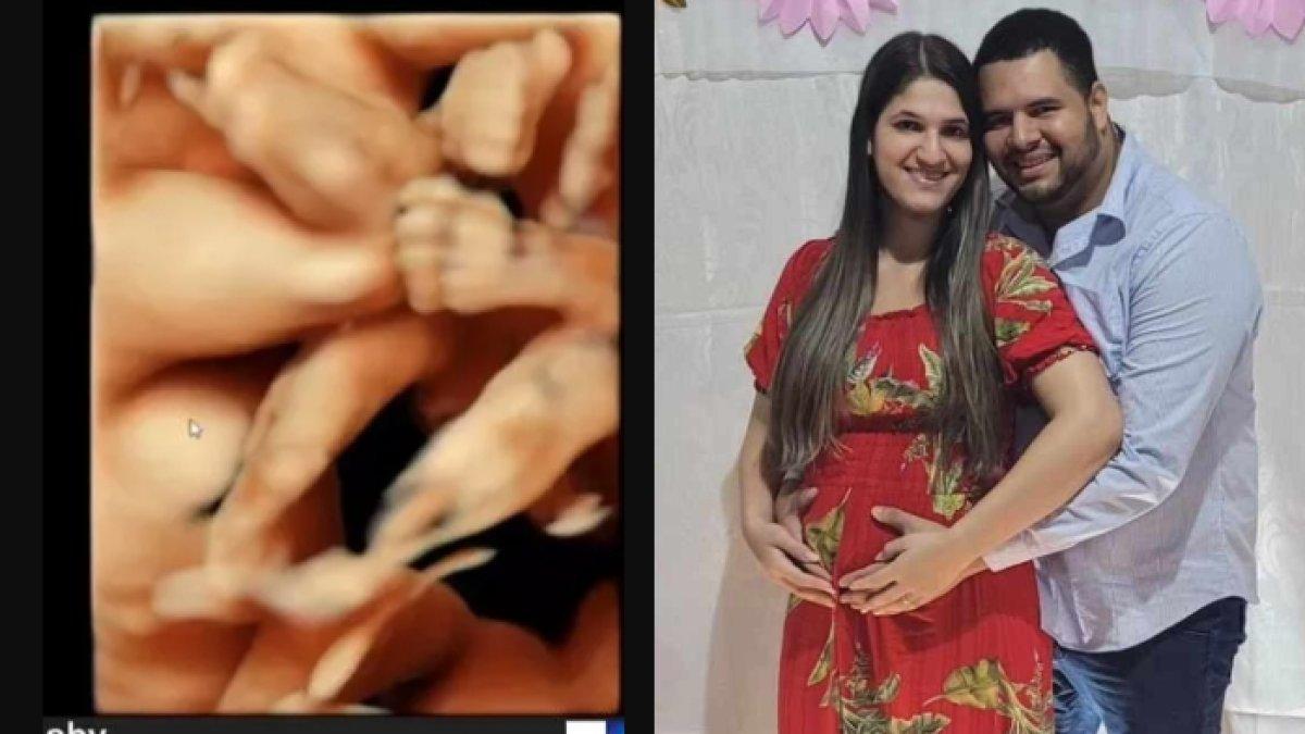 Wanita ini syok melahirkan enam bayi kembar dalam waktu 10 menit, bayi pertamanya berukuran mungil sekepalan tangan orang dewasa