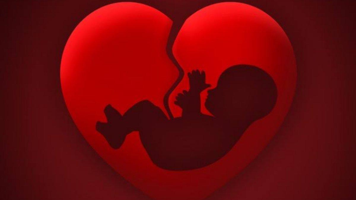 ILUSTRASI aborsi