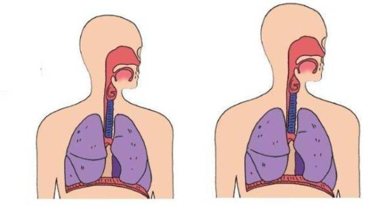 Ilustrasi pernafasan