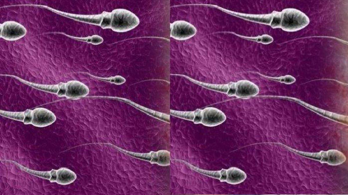 Ilustrasi sperma