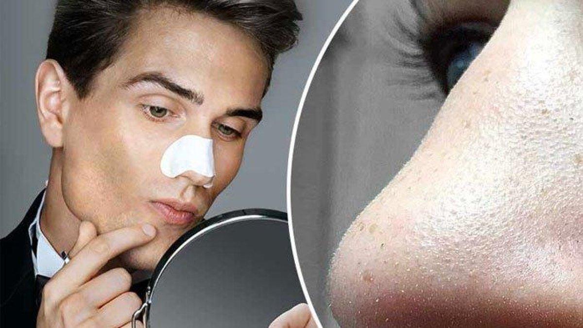 ILUSTRASI wajah bermasalah gegara kosmetik ilegal