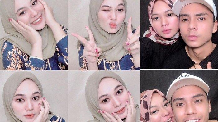 Lama Menghilang, Anisa Rahman eks Sabyan Pamer Foto USG Bayi di Hari