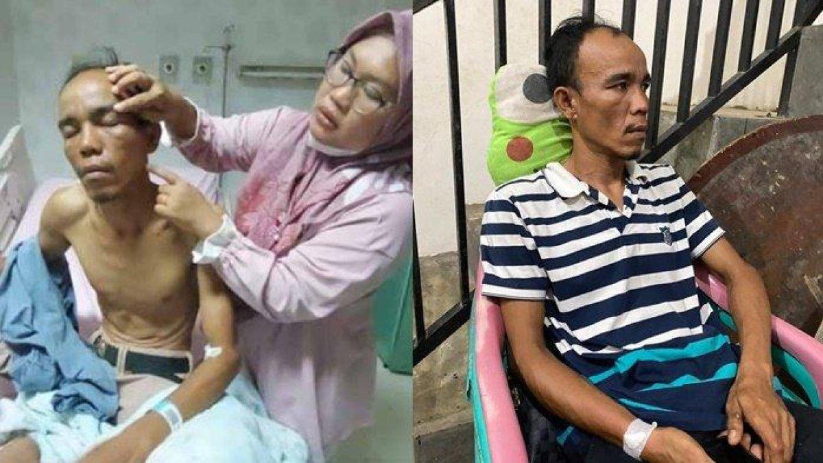 Kondisi korban kini terluka parah.