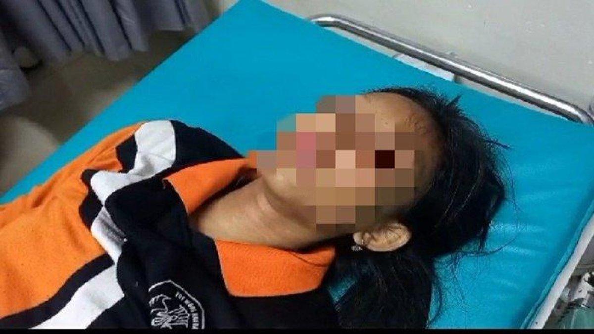 Kondisi korban penganiayaan pacar di Palembang, babak belur
