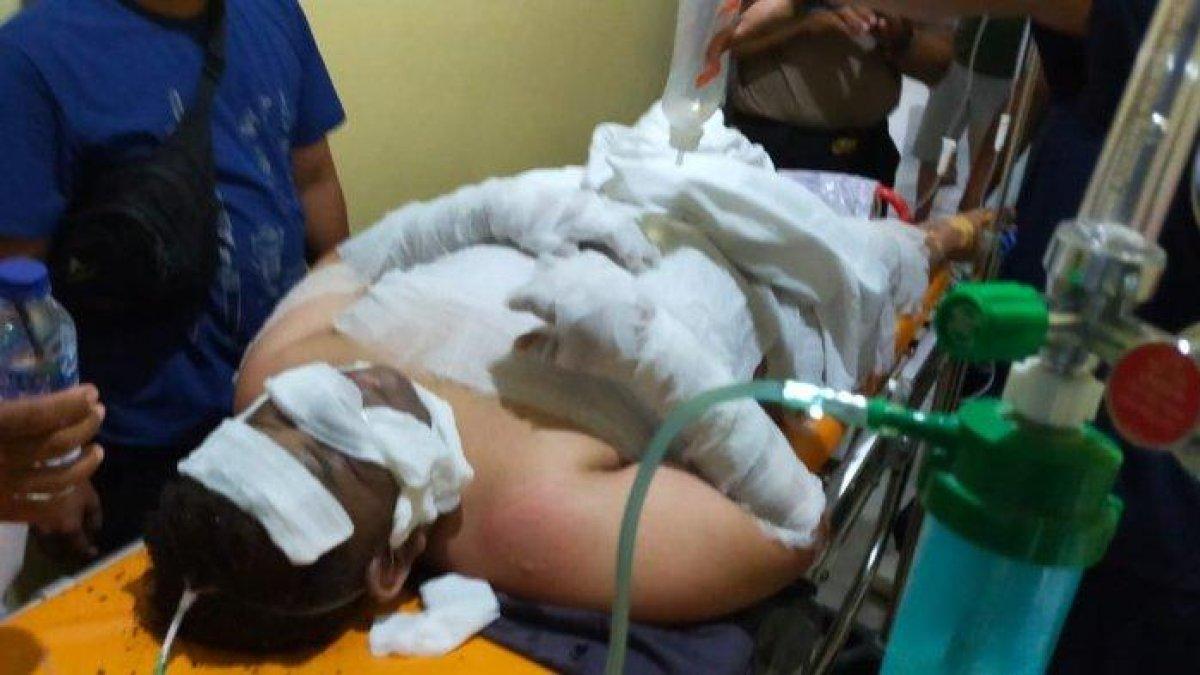 Korban ledakan septic tank salah satu rumah kos di Kabupaten Wajo, Sulawesi Selatan, Sahda Yusuf (26)