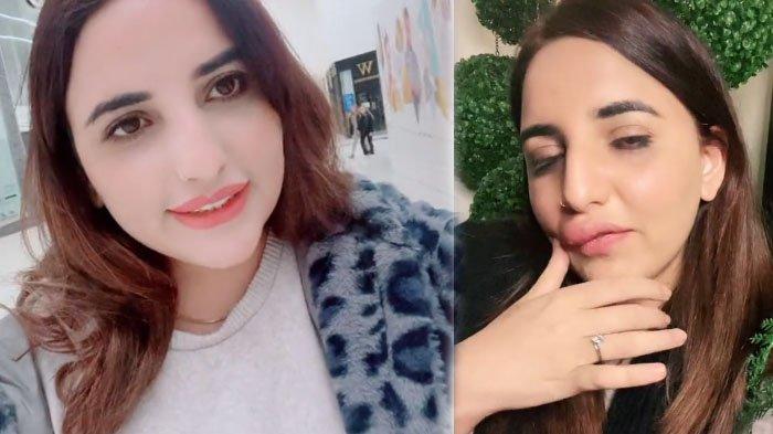 Viral artis TikTok apes saat melakukan filler bibir