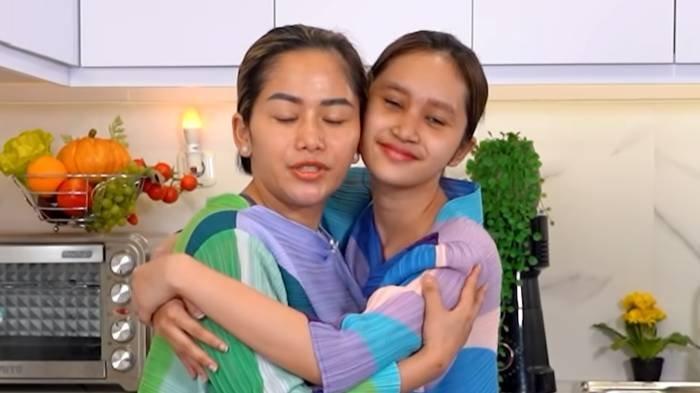 Nasib Permesta Dhyaz, putri Youtuber Farida Nurhan setelah oplas hidung